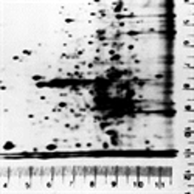 Picture for category Autoradiography Ruler Set