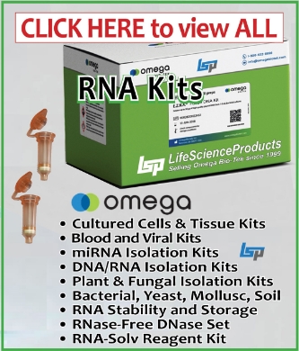 Picture for category 4) RNA & DNA/RNA Kits, RNase-Free DNase Set